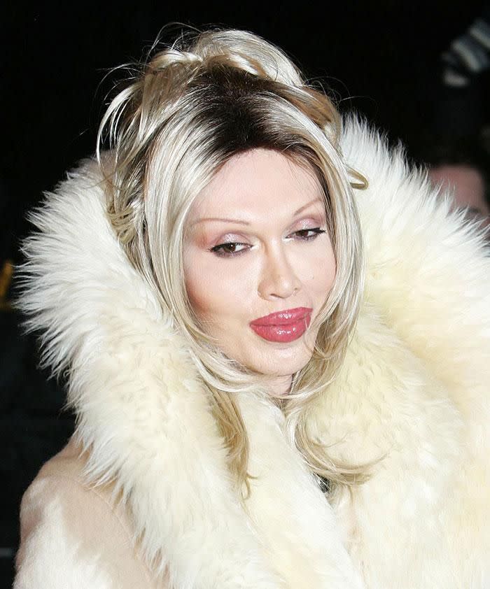 Pete Burns. Source: Getty Images.