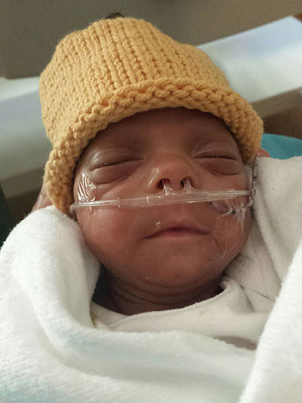 One of the Smallest Babies Ever Born (at Just 10 Ounces) Beats the Odds and Goes Home From Hospital| Babies, Real People Stories