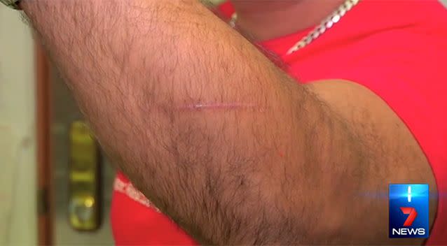 Mr Shukla suffered a cut to his arm in the incident. Photo: 7 News