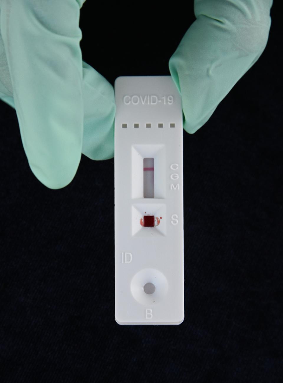 A coronavirus antibody rapid serological test kit.