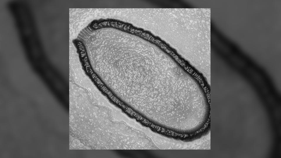 A section of a Pithovirus particle observed by transmission electron microscopy.