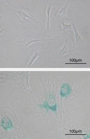 The Hallmarks of Cancer: 4 - Limitless Replicative Potential