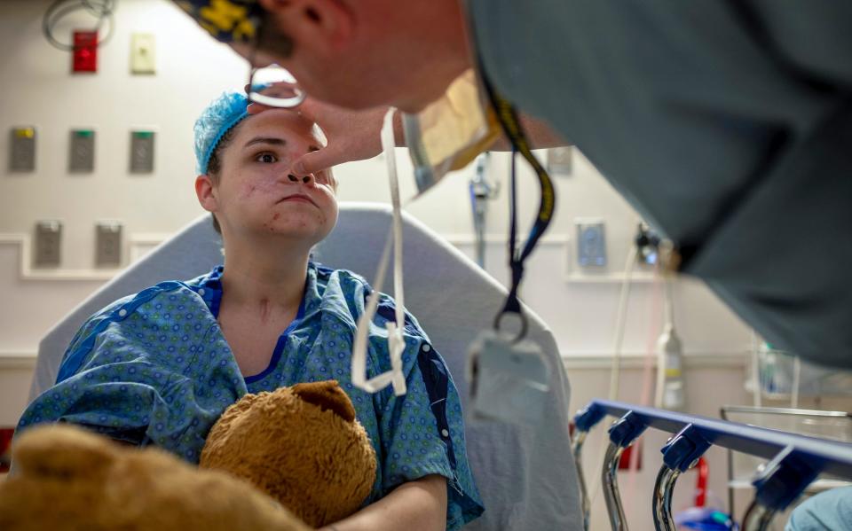 Amedy Dewey sits on a hospital bed as Christian Vercler, plastic surgeon, checks on Dewey's nose before her facial reconstruction surgery at the University of Michigan C.S. Mott Children's Hospital in Ann Arbor on Monday, July 24, 2023.