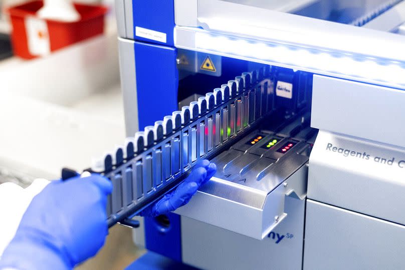 A laboratory scientist processes upper respiratory samples from patients suspected of having COVID-19 at the Stanford Clinical Virology Laboratory in Palo Alto, February 2021.