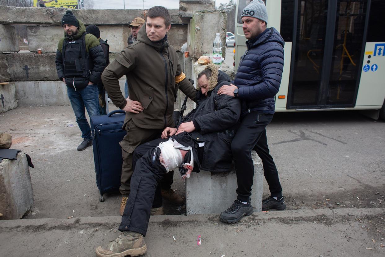 Yuriy, who who was shot in the leg while evacuating civilians from the shelled city of Irpin, receives first aid on March 6, 2022, in Kyiv, Ukraine.