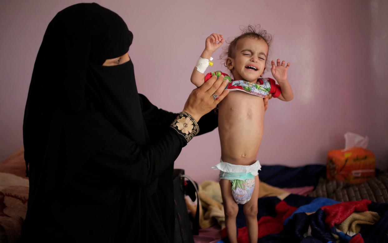 In this Nov. 23, 2019 file photo, a woman holds her malnourished boy at a feeding center at the Al-Sabeen Hospital in Sanaa, Yemen. After a visit to Yemen the World Food Program's executive director, David Beasley, warned that his underfunded organization may be forced seek hundreds of millions of dollars in private donations in a desperate bid to stave off widespread famine in the coming months. - Hani Mohammed /AP