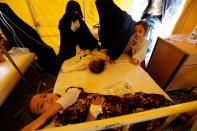 <p>Yemeni children suspected of being infected with cholera receive treatment at Sabaeen Hospital in Sana’a, on June 13, 2017.<br> Six weeks into the second outbreak of the deadly disease in less than a year, at least one patient checks in at Sabaeen every 60 seconds — a level of emergency that overwhelms staff. (Mohammed Huwais/AFP/Getty Images) </p>