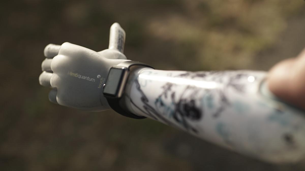 A Prosthetic Arm That Gives Amputees the Sense of Touch - Bloomberg