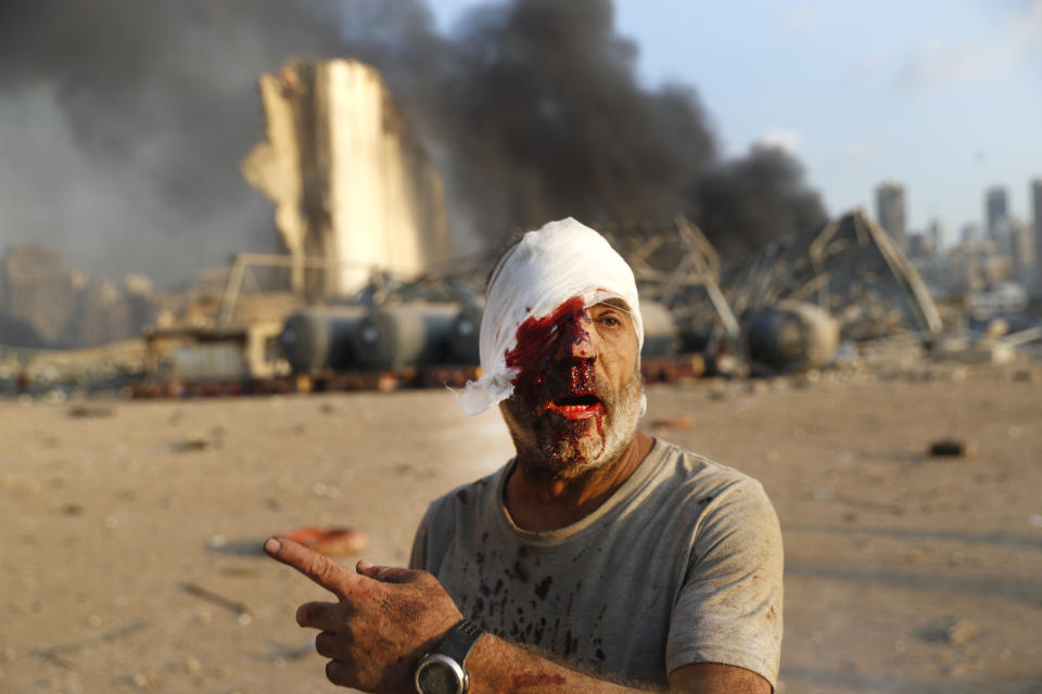 An injured man stands at the scene of an explosion that hit the seaport in Beirut Lebanon, Tuesday, Aug. 4, 2020. Massive explosions rocked downtown Beirut on Tuesday, flattening much of the port, damaging buildings and blowing out windows and doors as a giant mushroom cloud rose above the capital. Witnesses saw many people injured by flying glass and debris. (AP Photo/Hussein Malla)