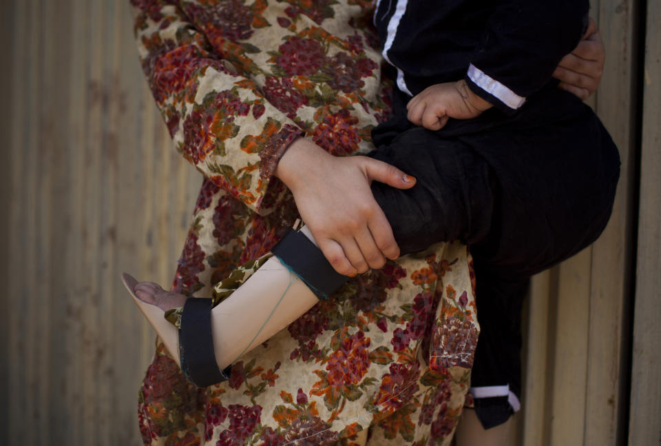 FILE - In this Wednesday, May 30, 2012 file photo, Fariha, a 13-month-old girl diagnosed with polio, whose legs are bound in small plastic braces, is carried around by her older sister Sana at their house in Peshawar, Pakistan. The World Health Organization said the northwestern Pakistani city of Peshawar has become the largest poliovirus reservoir in the world. (AP Photo/Anja Niedringhaus, File)