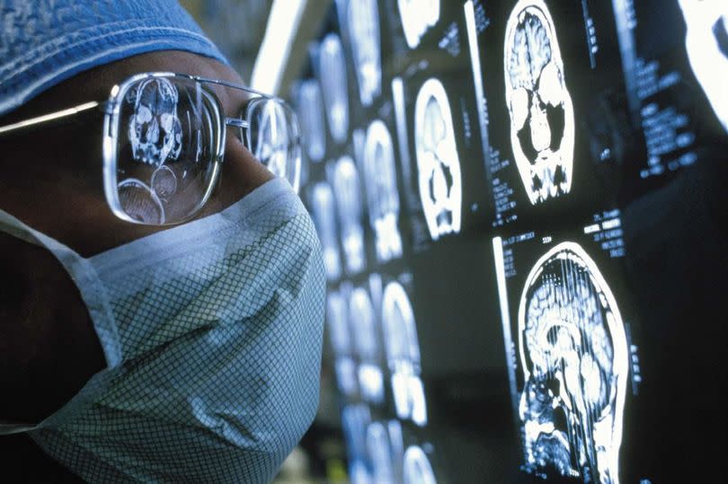 Generic image of surgeon looking at brain scan