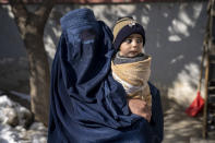 A mother with her malnourished child waits to receive help and check-up at a clinic that run by the WFP, in Kabul, Afghanistan, Thursday, Jan. 26, 2023. A spokesman for the U.N. food agency says malnutrition rates in Afghanistan are at record highs. Aid agencies have been providing food, education, healthcare and other critical support to people, but distribution has been severely impacted by a Taliban edict banning women from working at national and international nongovernmental groups. (AP Photo/Ebrahim Noroozi)