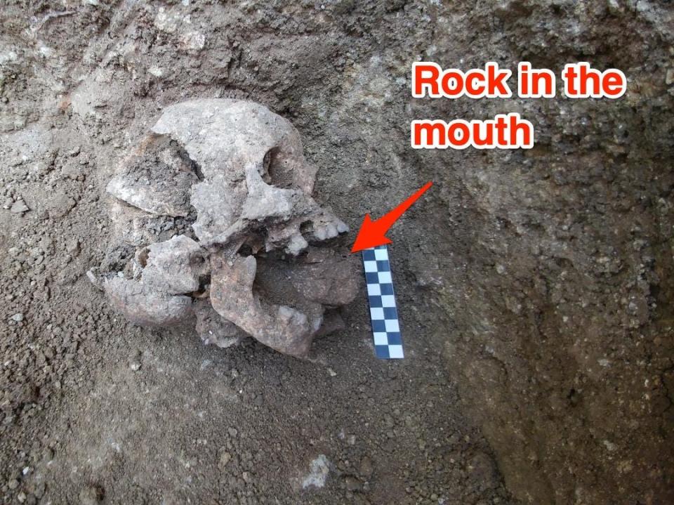 A skull is seen in situ, a rock is placed in the child's mouth.