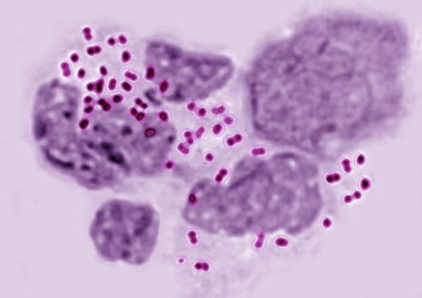 Neisseria Gonorrhoeae