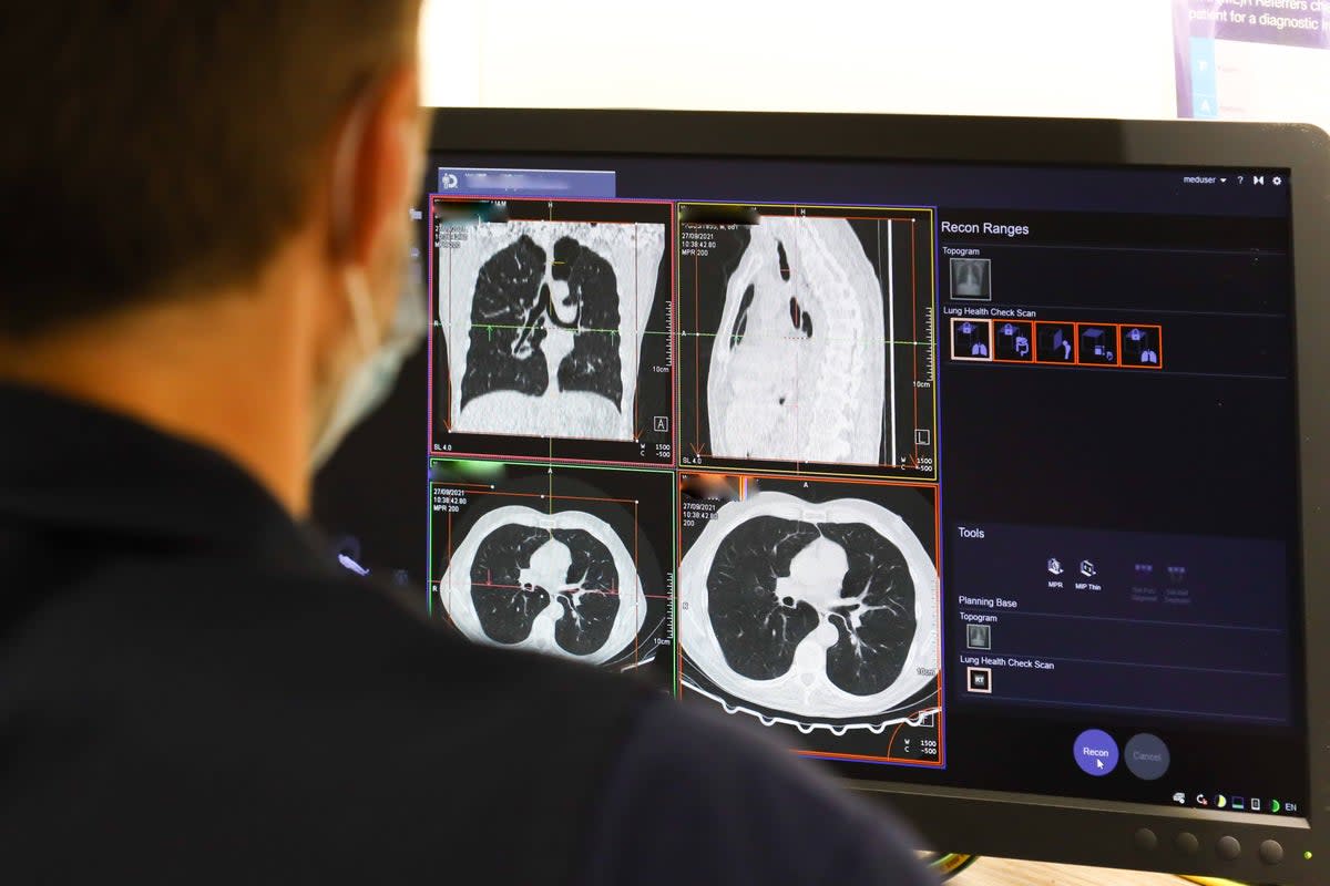 A member of staff looks at the results of a lung scan (stock photo)  ((PA Wire))