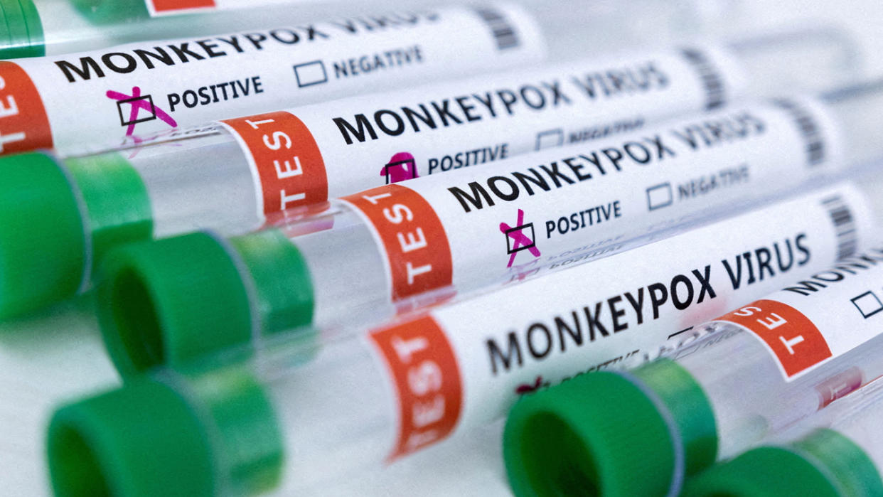 Test tubes labeled: Monkeypox Virus.