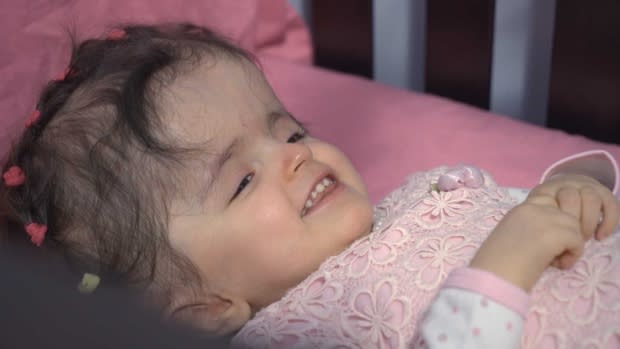 Girl, 2, survives 'drastic' surgery to reconstruct her skull