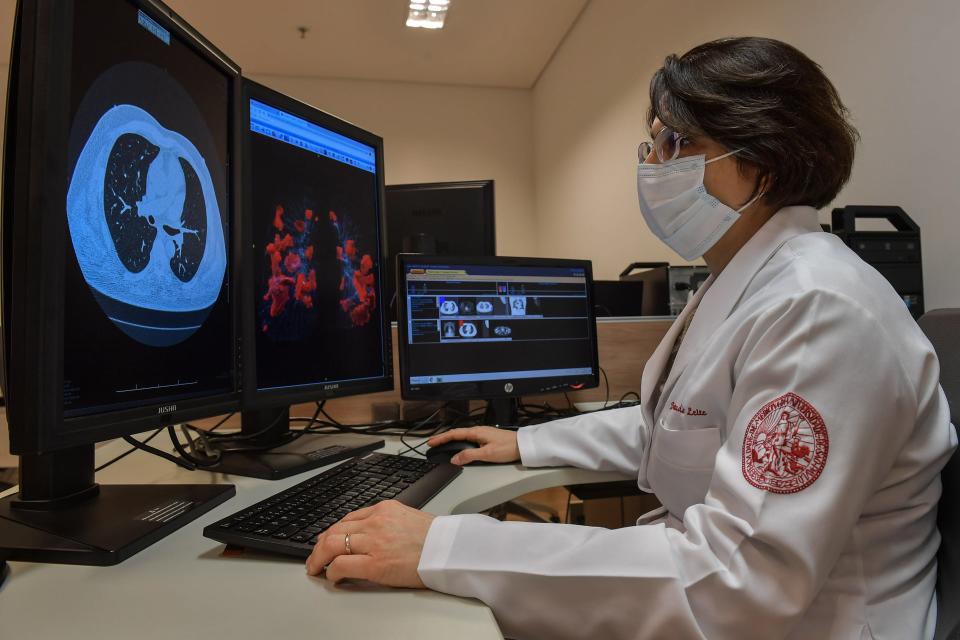 coronavirus lung scan