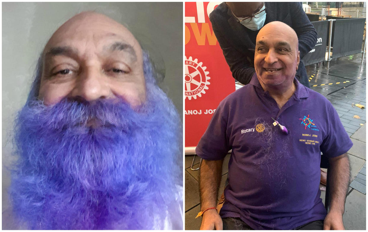 Dr Manoj Joshi, before and after. (SWNS) 