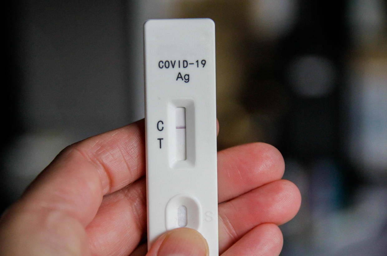 Antigen test