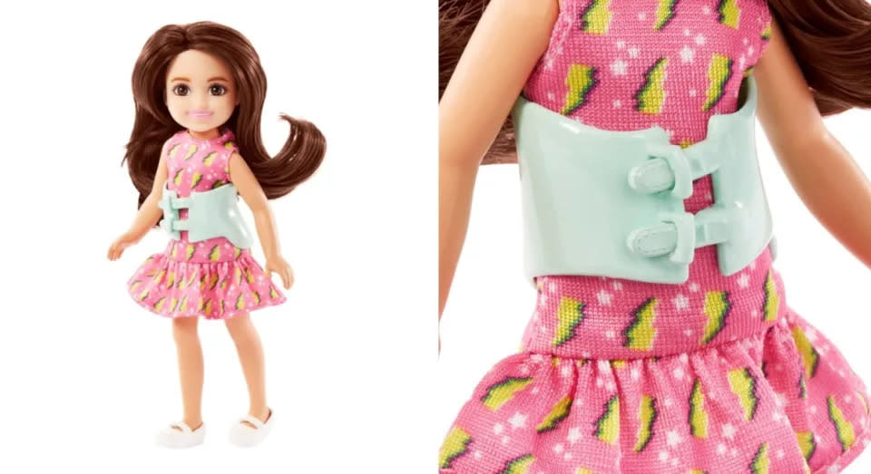 Barbie mit Skoliose-Gürtel