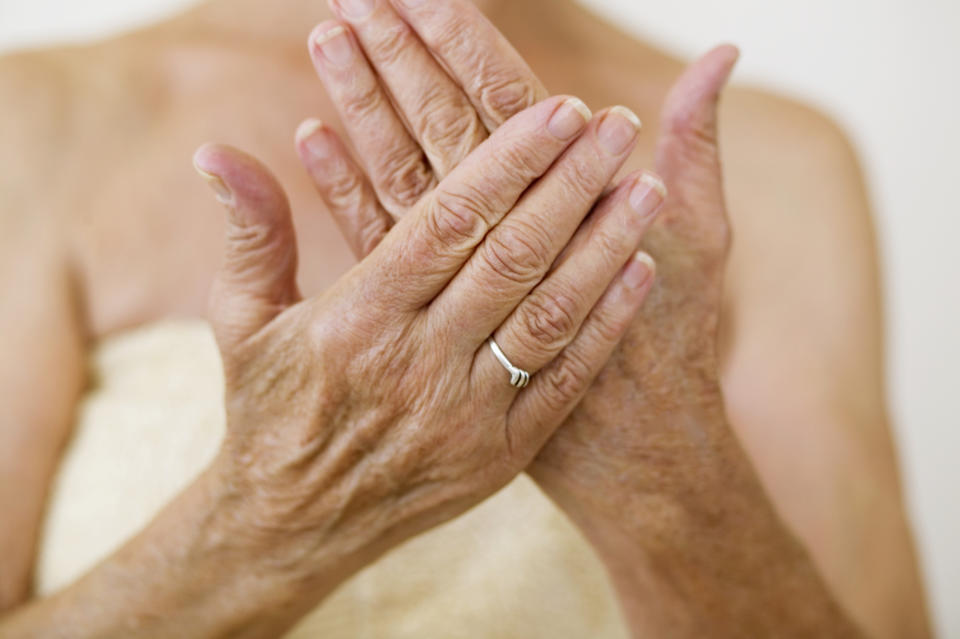 Mature woman overlaying crepey hands.