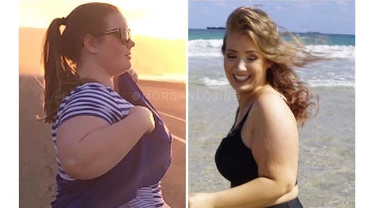 Instagram deleted this woman’s weight loss side-by-sides, and we’re confused