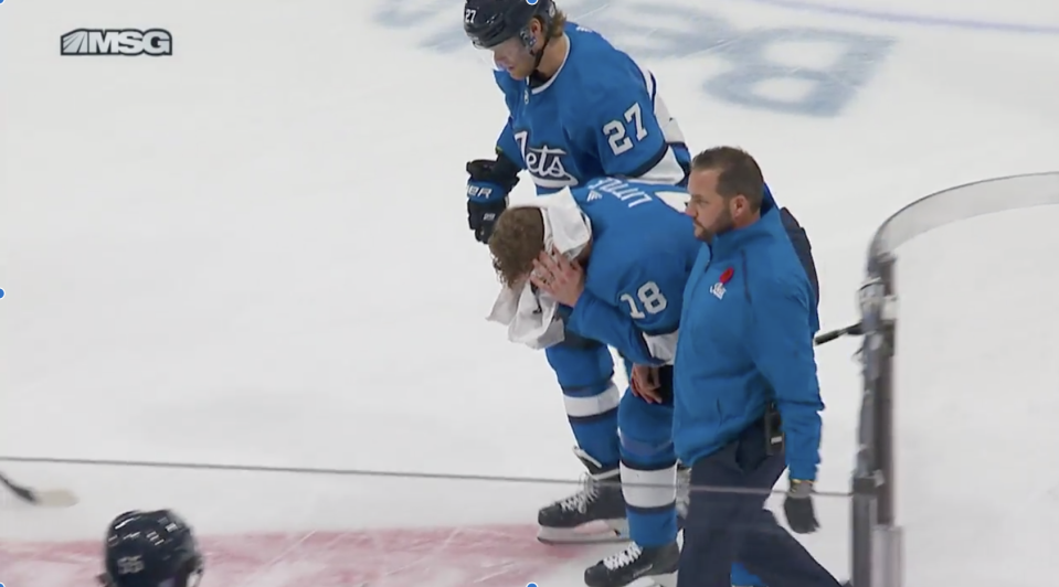 The Jets veteran took a slap shot from teammate Nikolaj Ehlers straight to the head and left the game. (MSG Network)