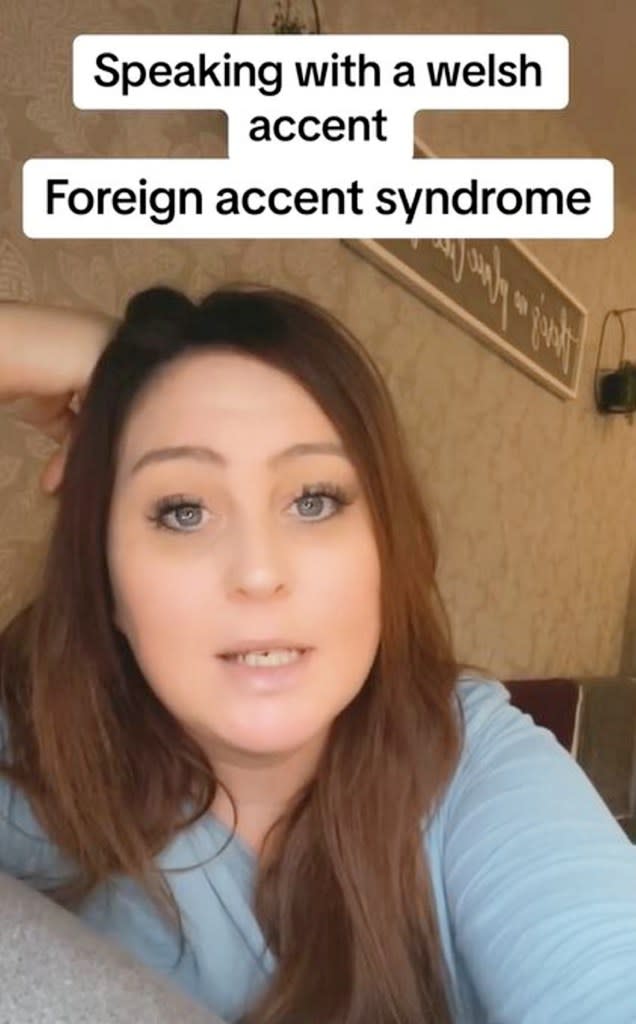 She said she has something called Foreign Accent Syndrome and her doctor said there isn’t anything she can do about it. Zoe Coles / SWNS