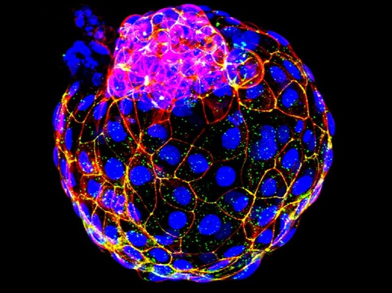 An artificial blastocyst – the very early formation of an embryo – made from human stem cells (University of Texas Southwestern Medical Centre)