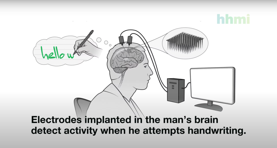 An illustration of the way BrainGate's "brain-to-text" brain-computer interface works to help paralyzed people write out their thoughts.