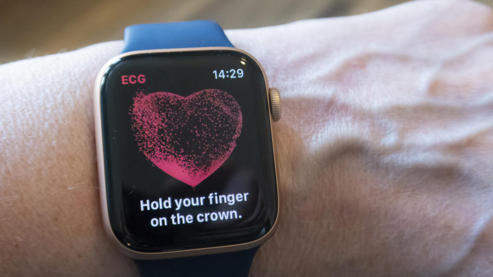 Alles am Arm: Neben den vielfältigen Gadgets bietet die Apple Watch auch die Funktion eines EKGs an. (Bild: Getty)