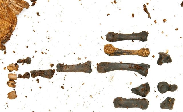 Ancient human remains found in Northern Ireland