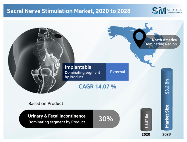 Sacral Nerve Stimulation (SNS) - Bowel / Faecal Incontinence