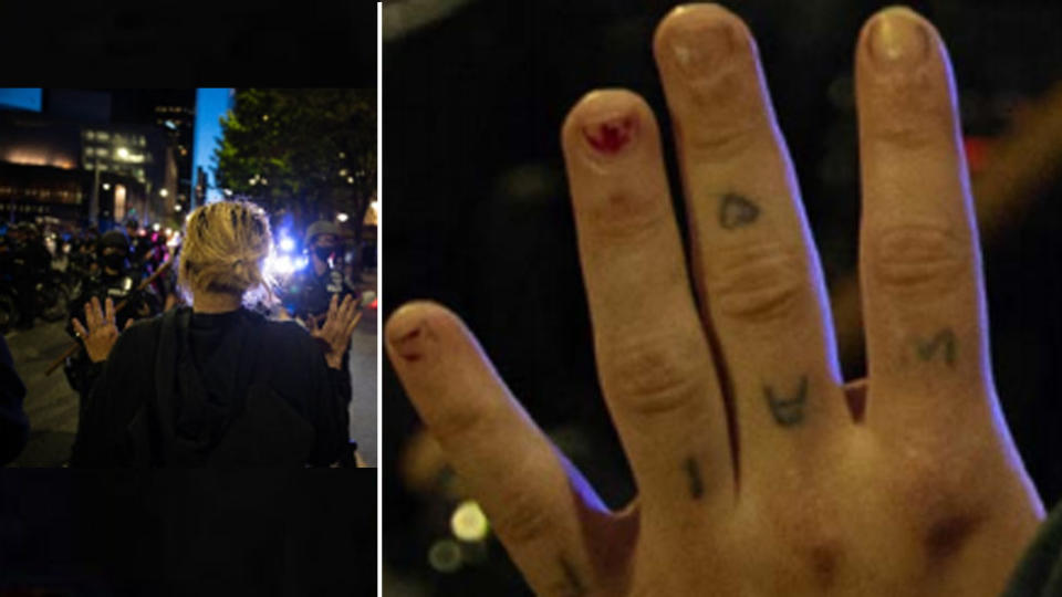Two photos show a woman with her hands up and a close up of her hand with a distinctive tattoo visible.