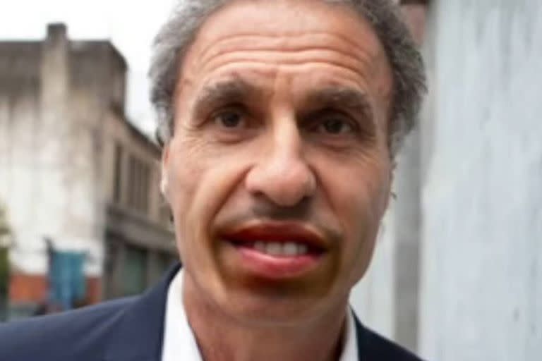 La imagen editada de Ruggeri con los labios de Ramírez