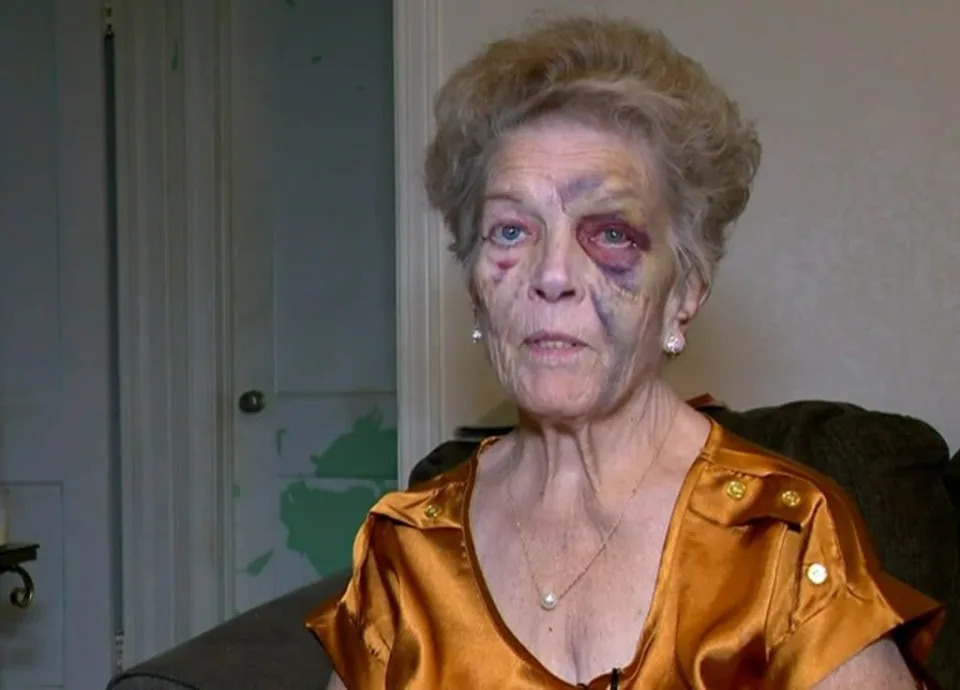 A carjacker brutally beat Texas grandmother, Shirlene Hernandez, only to die later in a crash involving the stolen vehicle (WCAX3)