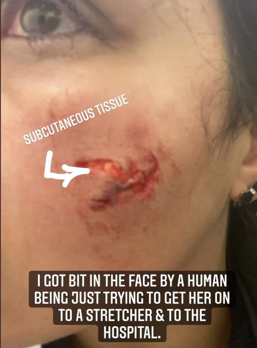 A close-up of the injury taken by Jenna Piscitello. Source: Twitter