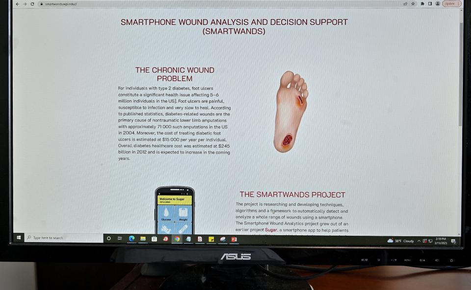 The “Deep Infected Wound Detector,” a smartphone application, is being developed by a team led by Worcester Polytechnic Institute researcher Emmanuel Agu and UMass Chan Medical School.