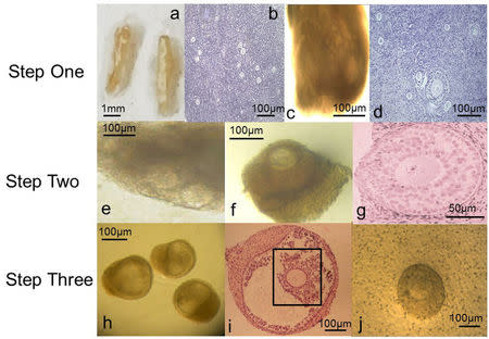 A series of magnified images show human eggs in development stages. Prof. Evelyn Telfer and Dr. Marie McLaughlin/University of Edinburgh/Handout via REUTERS