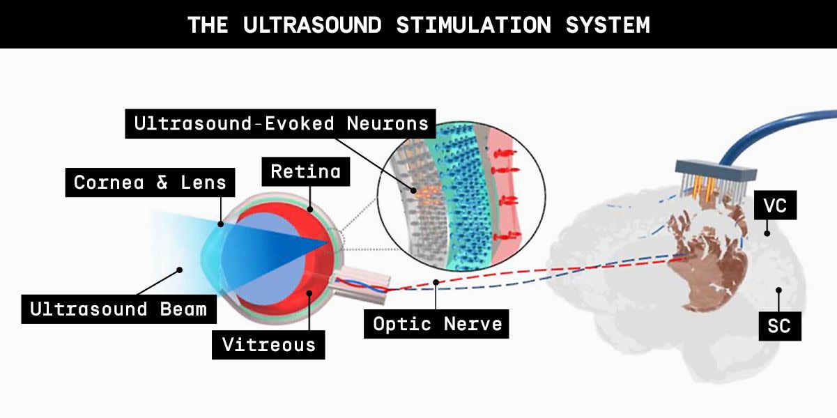 Photo credit: Popular Mechanics; Courtesy CC BY 4.0/X Qian et al. BME Frontiers 10.34133/2022/9829316