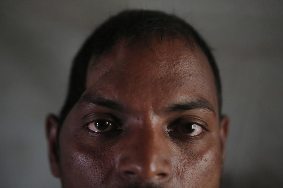 In this Nov. 24, 2016 photo, Salit Mandal, 28, sits on his bed at his home in Parikauli Village, Saptari district, a region where many men have left to work abroad as unskilled laborers, Nepal. Mandal, who rolled off a third-level bunk in Malaysia and smashed his skull, is in debt and partially paralyzed, and lives with his parents. His family had pinned their hopes on him after he returned from an earlier stint in Qatar with enough money to build a five-bedroom house. Now his mom takes a visitor aside and says the situation is horrible, Salit can't squat by himself over the pit toilet, she says, and she has to clean him up afterward. (AP Photo/Niranjan Shrestha)