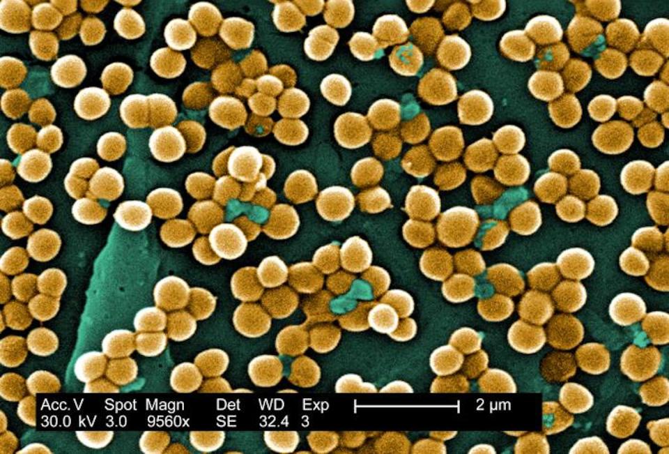 <em>Staphylococcus aureus</em>, or MRSA, is a common source of bacterial coinfections. <a href="https://phil.cdc.gov/Details.aspx?pid=10046" rel="nofollow noopener" target="_blank" data-ylk="slk:Janice Haney Car/Centers for Disease Control and Prevention;elm:context_link;itc:0;sec:content-canvas" class="link ">Janice Haney Car/Centers for Disease Control and Prevention</a>