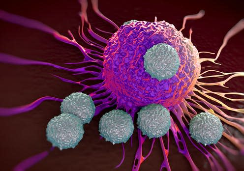 <span class="caption">Not all tumours can be detected by the body's immune system.</span> <span class="attribution"><a class="link " href="https://www.shutterstock.com/image-illustration/tcells-attacking-cancer-cell-illustration-microscopic-313800779" rel="nofollow noopener" target="_blank" data-ylk="slk:Peddalanka Ramesh Babu/ Shutterstock;elm:context_link;itc:0;sec:content-canvas">Peddalanka Ramesh Babu/ Shutterstock</a></span>