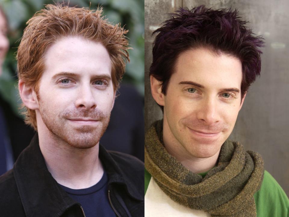 seth green redhead