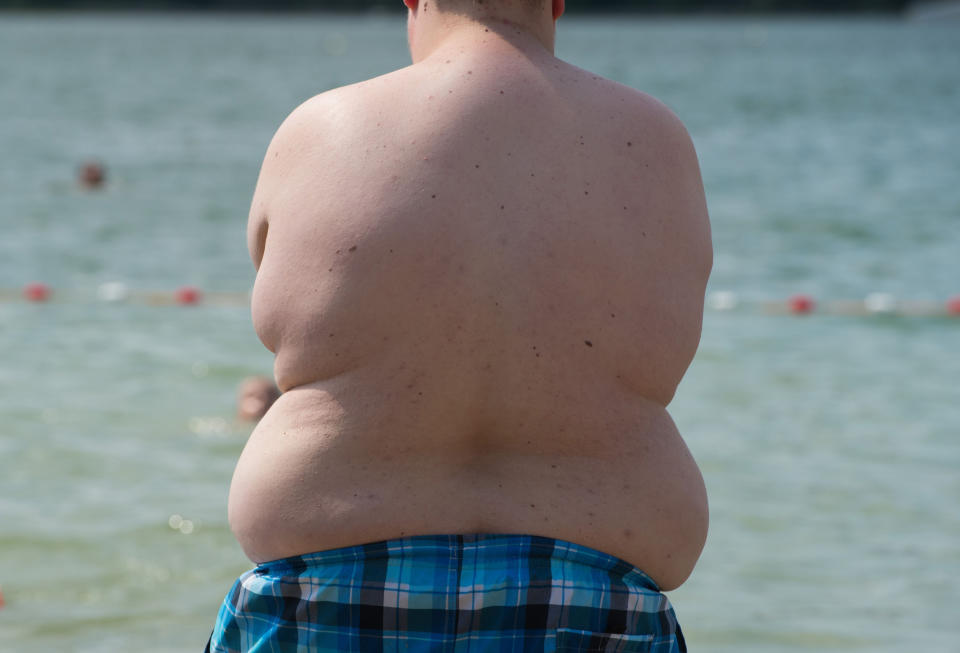Ein übergewichtiger Junge steht am einem Badesee am Wasser. (Bild: Sebastian Kahnert/dpa-Zentralbild/dpa)
