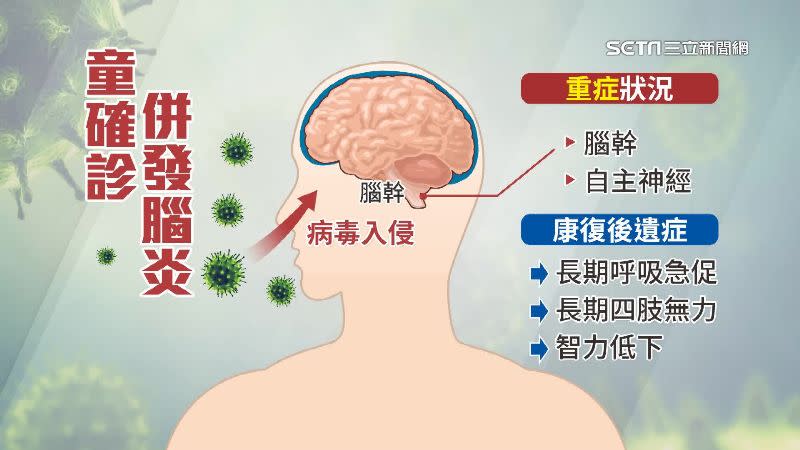 病毒若入侵到腦幹或自主神經就嚴重許多。