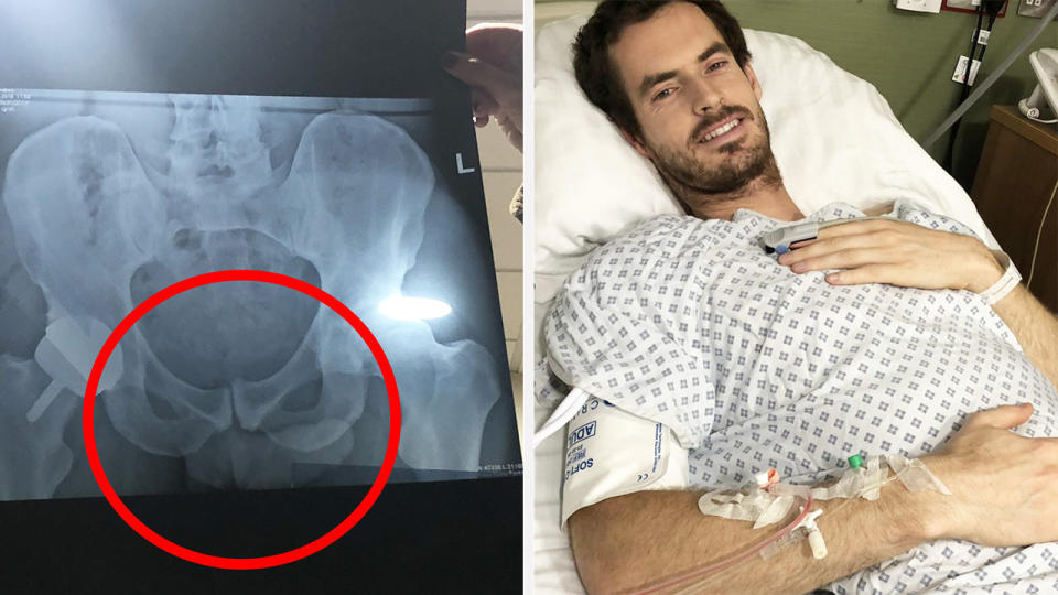 Andy Murray has opened up about a picture he posted on Instagram which fans believe shows a little more than he might have cared to share. Pictures: Instagram/andymurray