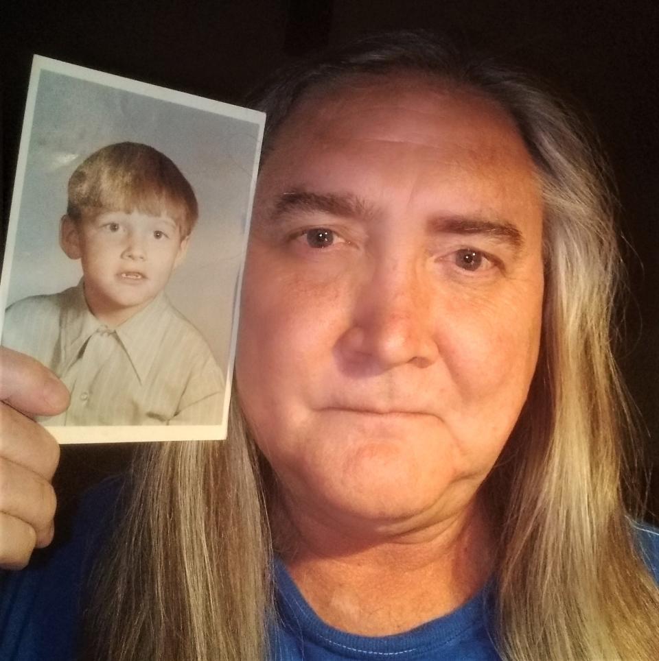 Tom O'Neill holds up his school picture from first grade, the year he fell out of a tree and into a pile of burning leaves.