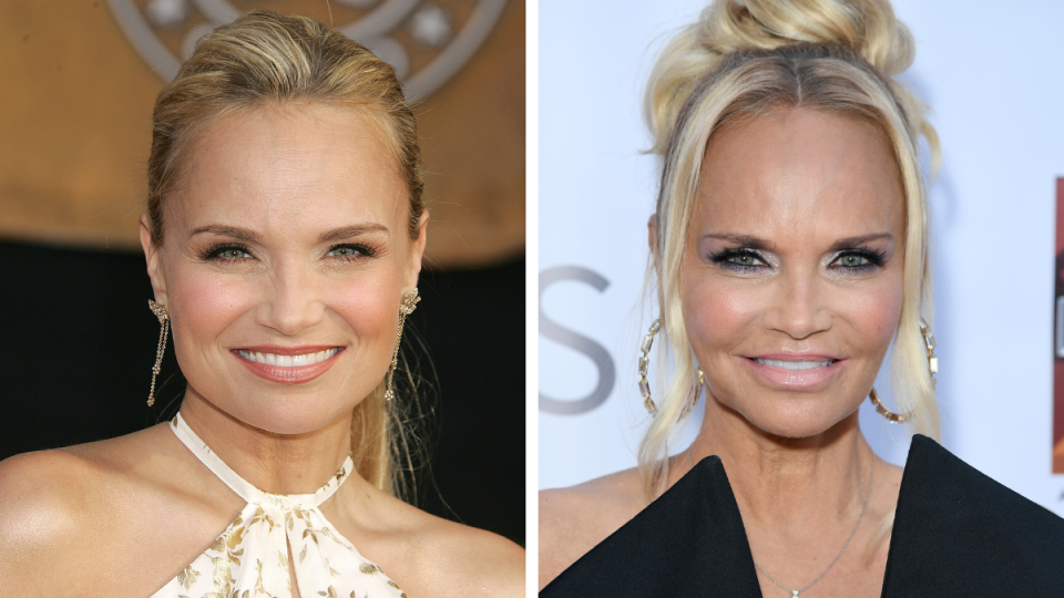 Kristin Chenoweth in 2006 and 2023